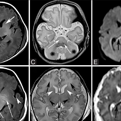 Brain scan images used for classification