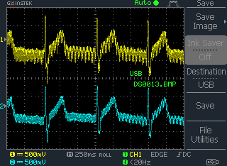 Electrocardiograph signal